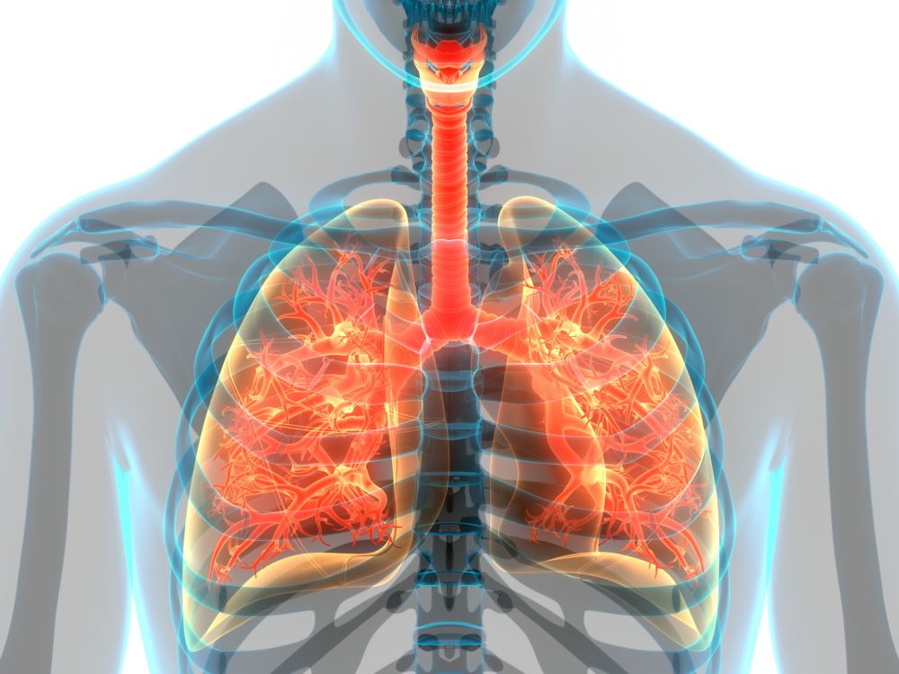 EBUS para diagnóstico de cáncer de pulmón