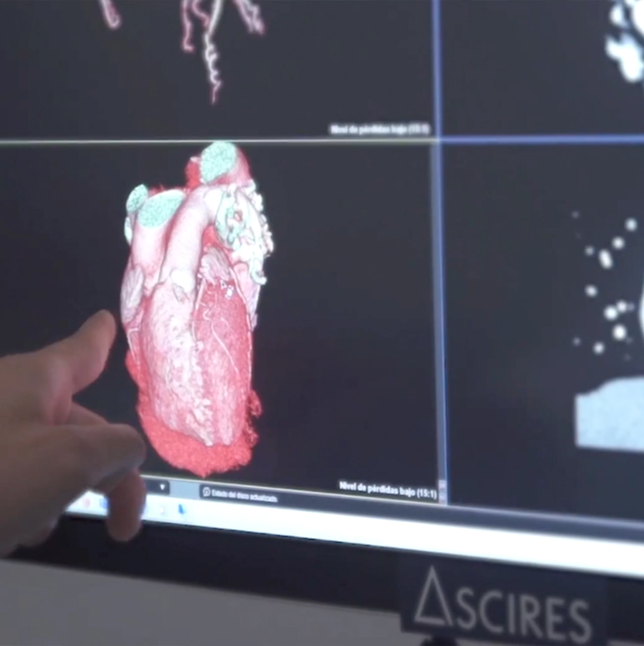 Cardiac studies in just one heartbeat
