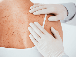 En Dermatología colaboramos con equipos multidisciplinares 