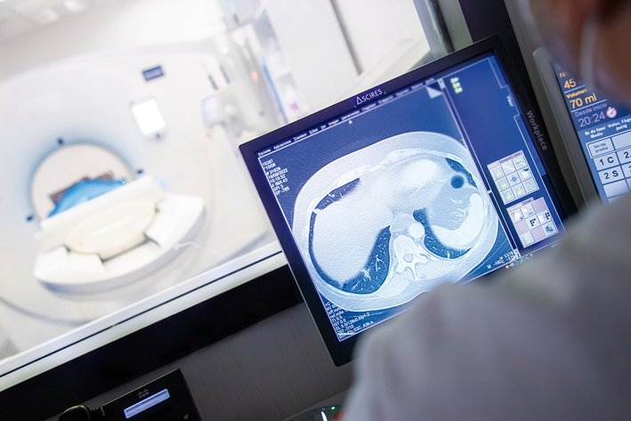 TC PULMONAR HOSPITAL ASCIRES VALENCIA