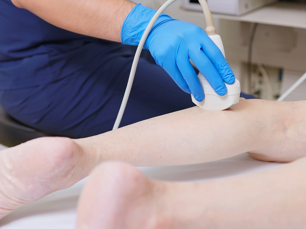 Varicose Vein Diagnosis with Doppler Ultrasound in a Single Visit